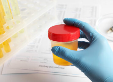 Nurse holding container with urine sample at table, closeup and space for text. Specimen collection